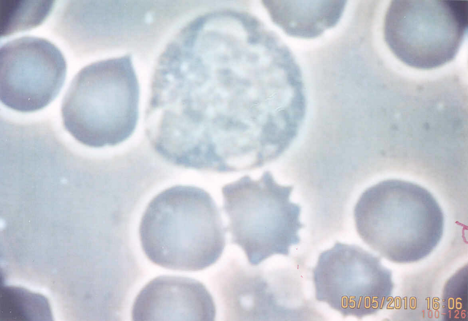 Blood sample 40x Phase contrast - Macrophage