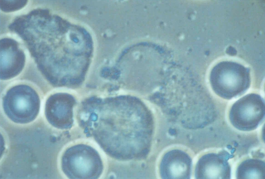 Healthy blood: erythrocytes, phagocytes