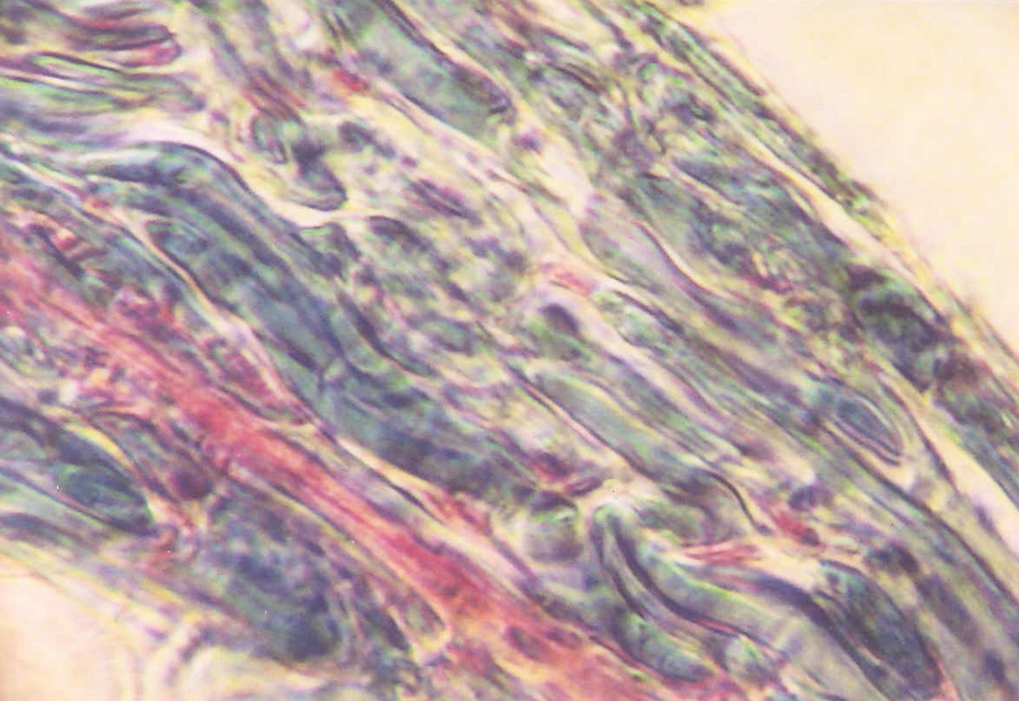 Tissue sample - 40x Phase contrast